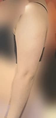 beforeImage